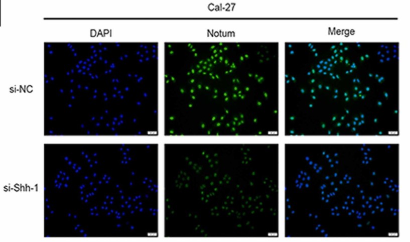 Cell immunofluorescence analysis of Notum expression in Shh knockdown Cal-27 cells.jpg